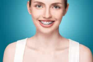 Adult Braces in Pembroke Pines and Plantation, FL Lucas Orthodontics