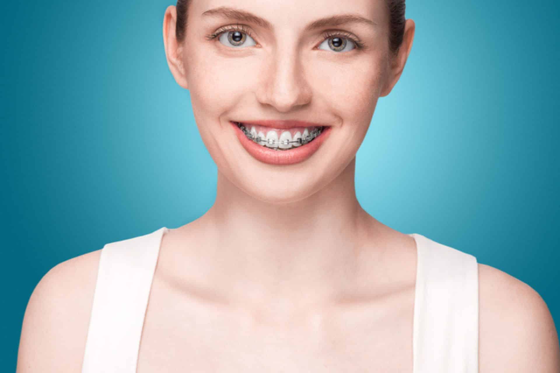 Adult Braces in Pembroke Pines and Plantation, FL Lucas Orthodontics